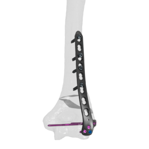 Codo
