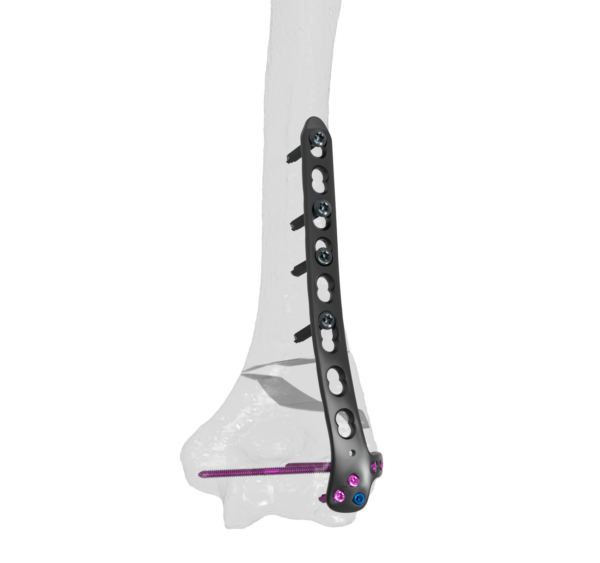 Codo