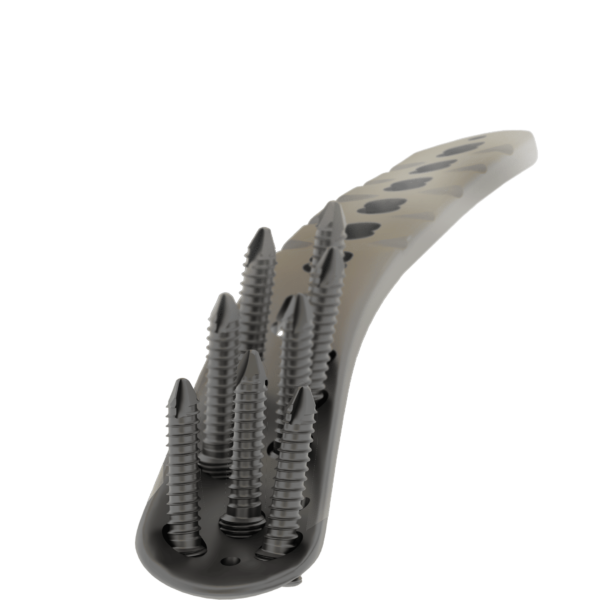 Affinity Tibia Distal - Imagen 4