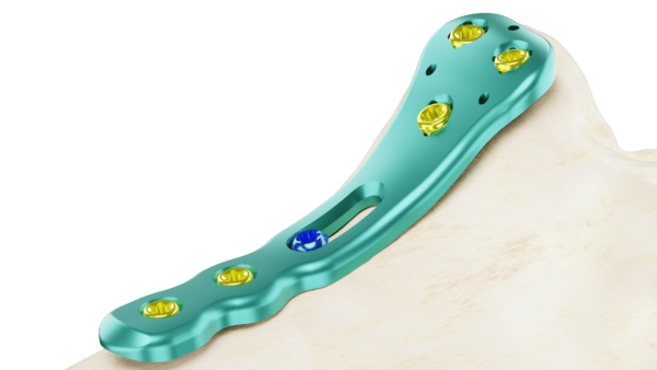 Affinity Tibia Proximal - Imagen 2