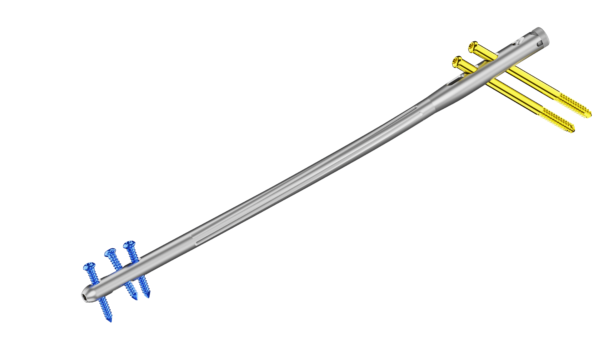 Clavo Support Reconstrucción Femoral - Imagen 2