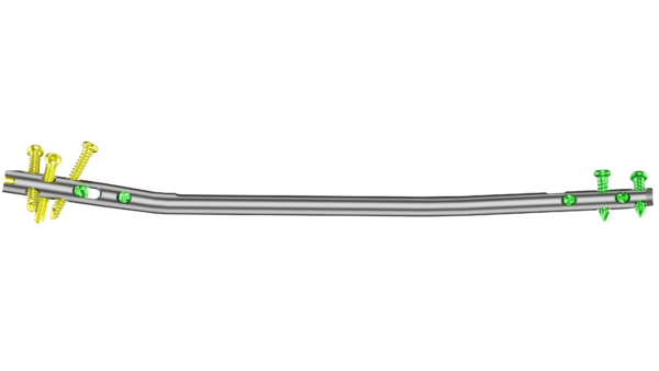Clavo Support Reconstrucción Tibial - Imagen 2